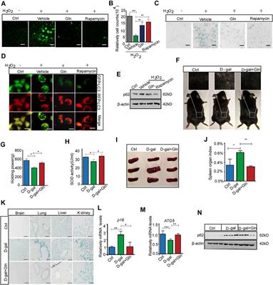 Glutamine Availability Regulates the Development of Aging Mediated by mTOR Signaling and Autophagy